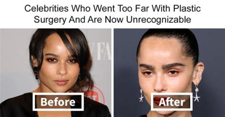 Exploring The World Of Plastic Surgery Comparison: A Deep Dive