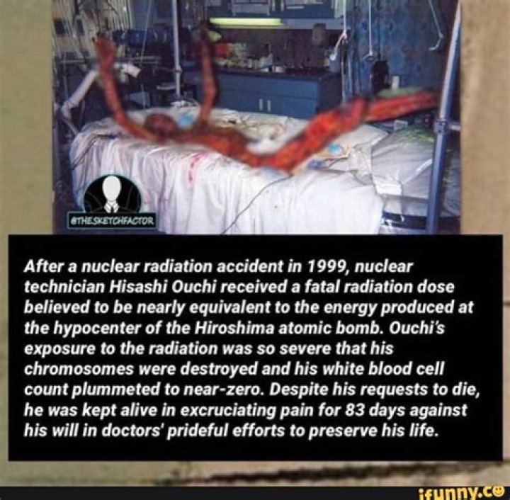 Hisashi Ouchi's Devastating Nuclear Accident: A Survivor's Tale
