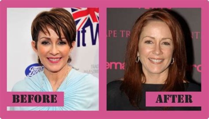 Patricia Heaton Cosmetic Surgery: Before And After Transformations