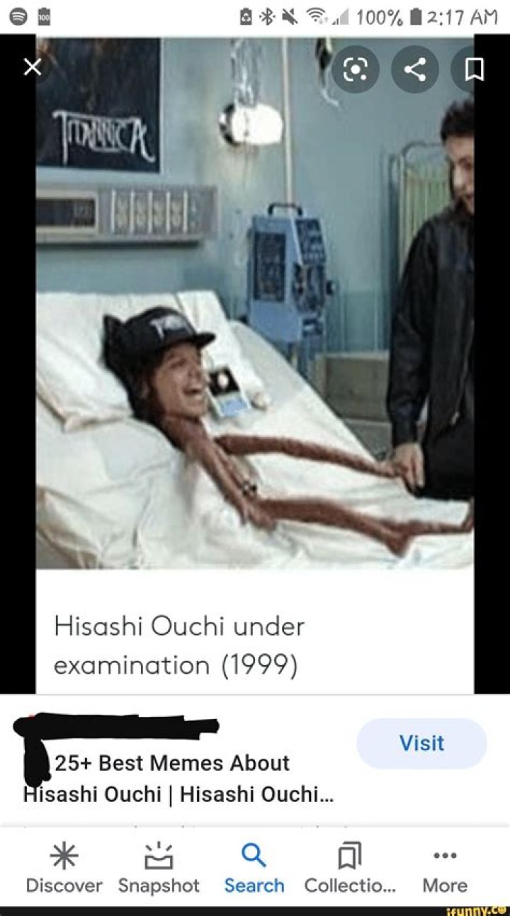 The Ultimate Guide To Hisahi Ouchi's Body: A Medical Marvel And Tragedy