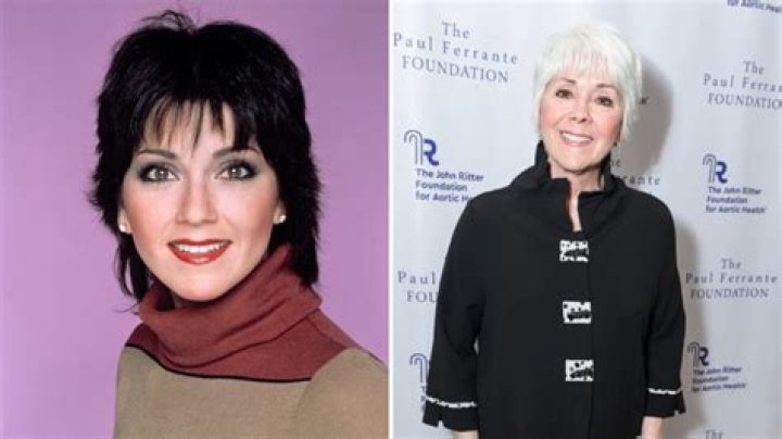 The Ultimate Guide To Joyce DeWitt Plastic Surgery: All The Details