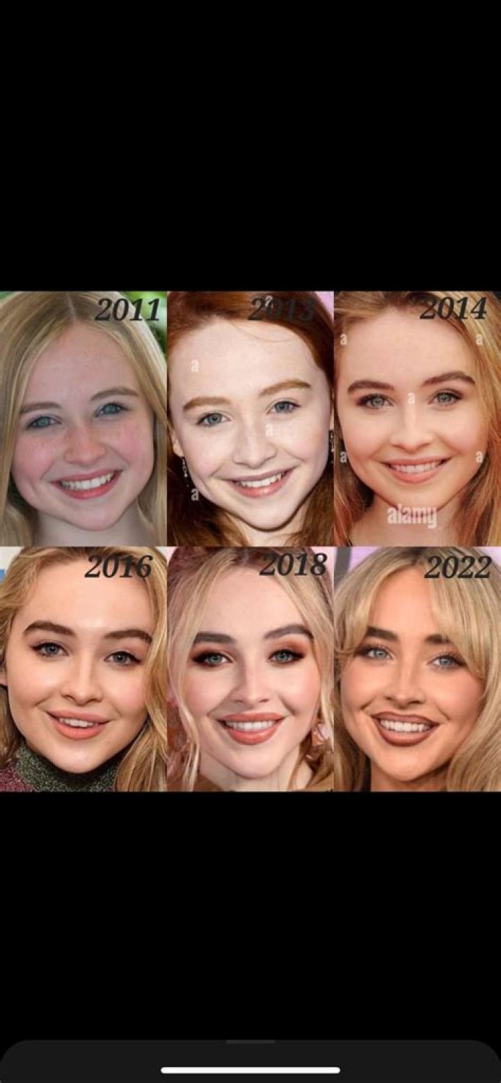 The Ultimate Guide To Sabrina Carpenter's Filler: Benefits, Risks, And Results