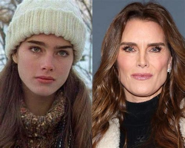 The Unbelievable Reason Why Brooke Shields Looks Like A Man