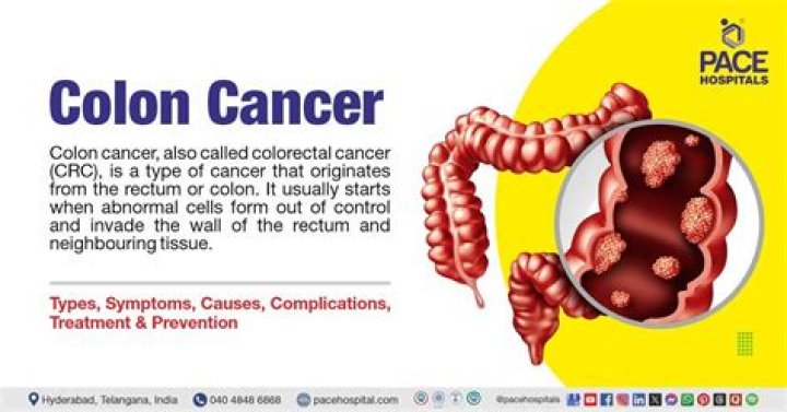 Unveiling Raquel Colon Cancer: Discoveries And Insights